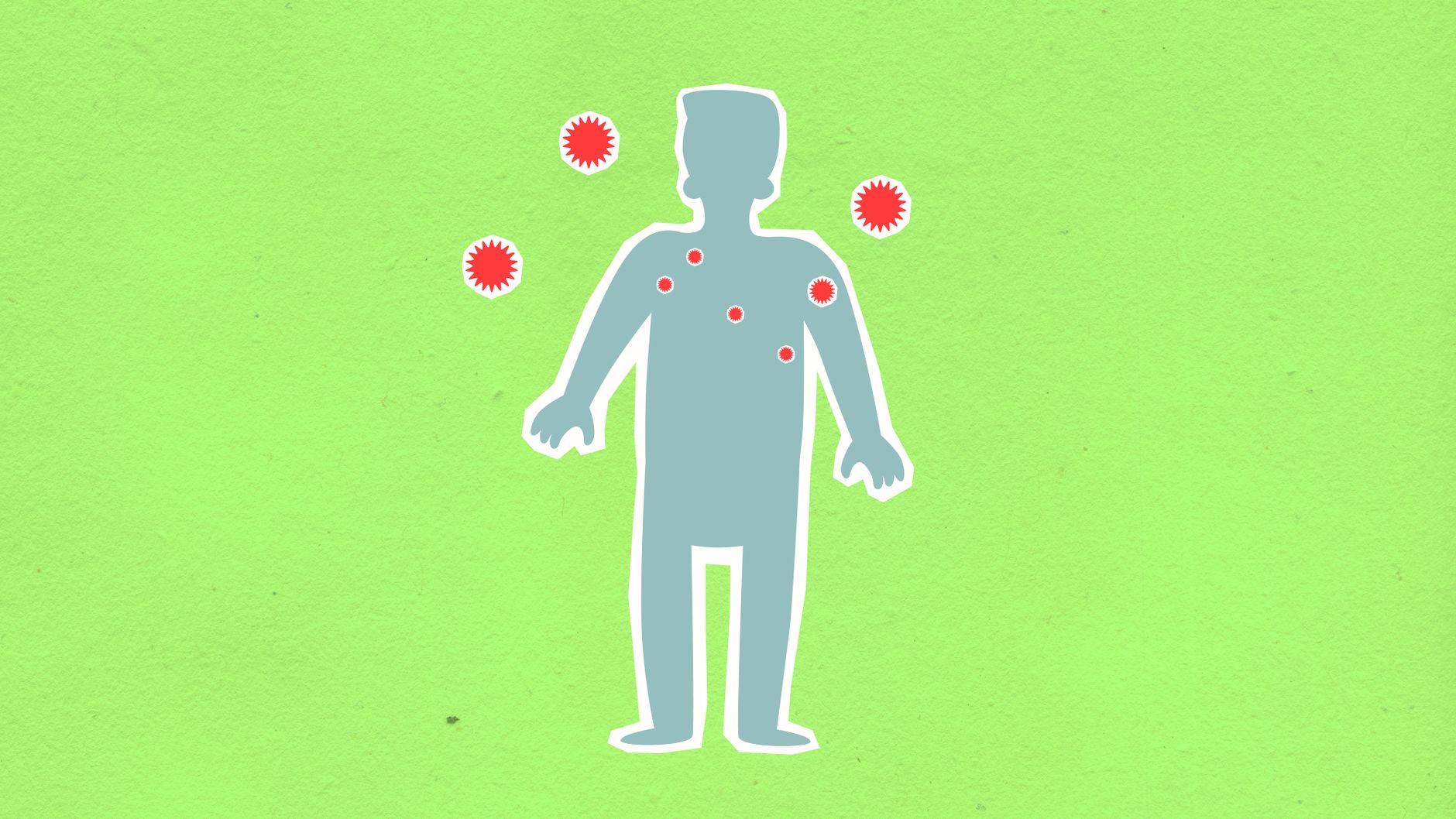 cyclosporiasis Michigan outbreak