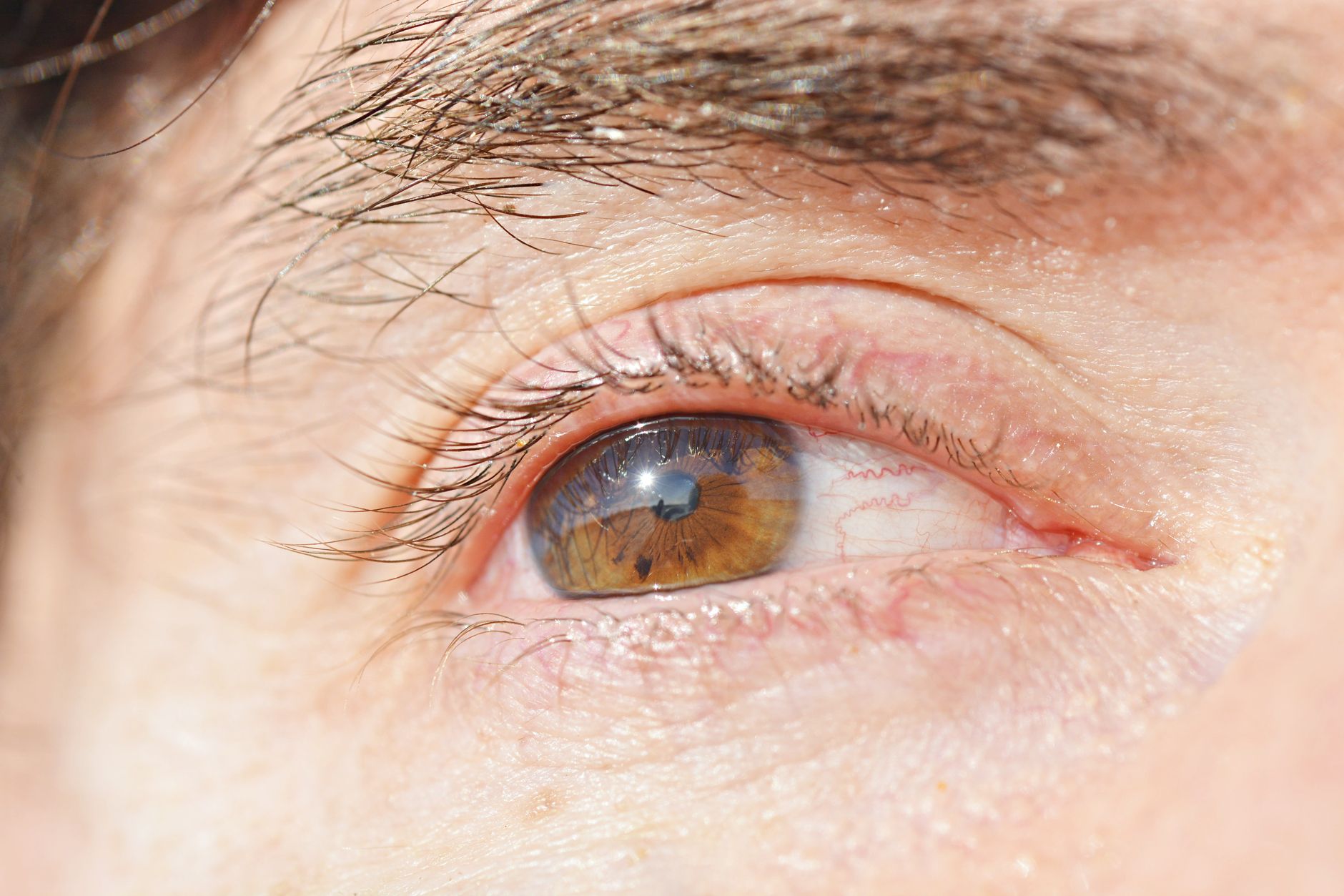 erectile dysfunction vision loss